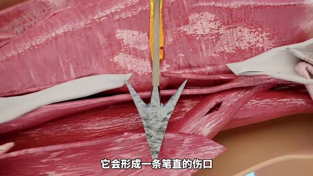 如果被弓箭刺中应该怎么办